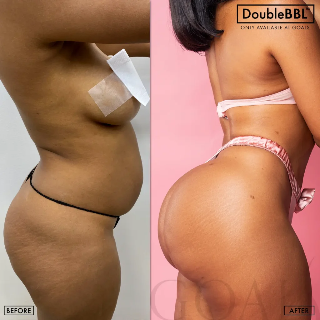 Before and after, patient 1
