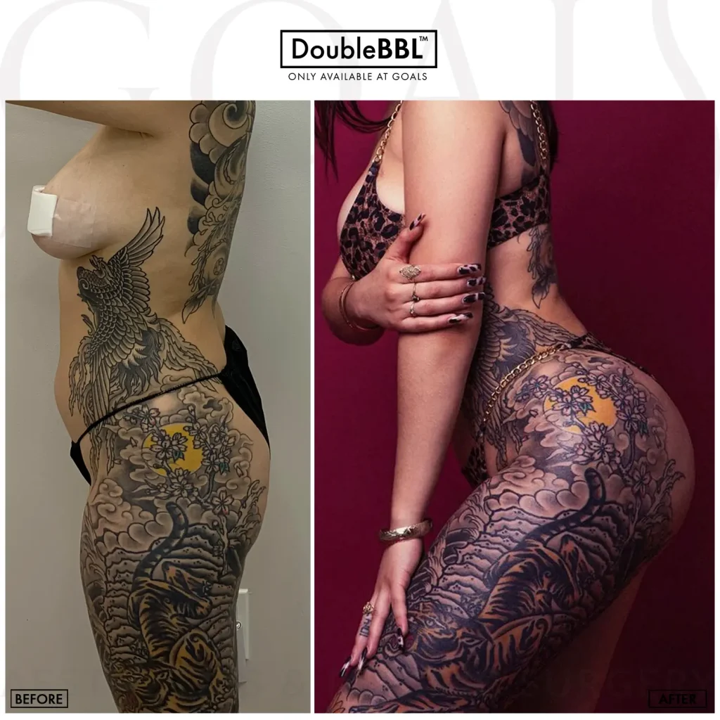 Before and after, patient 1