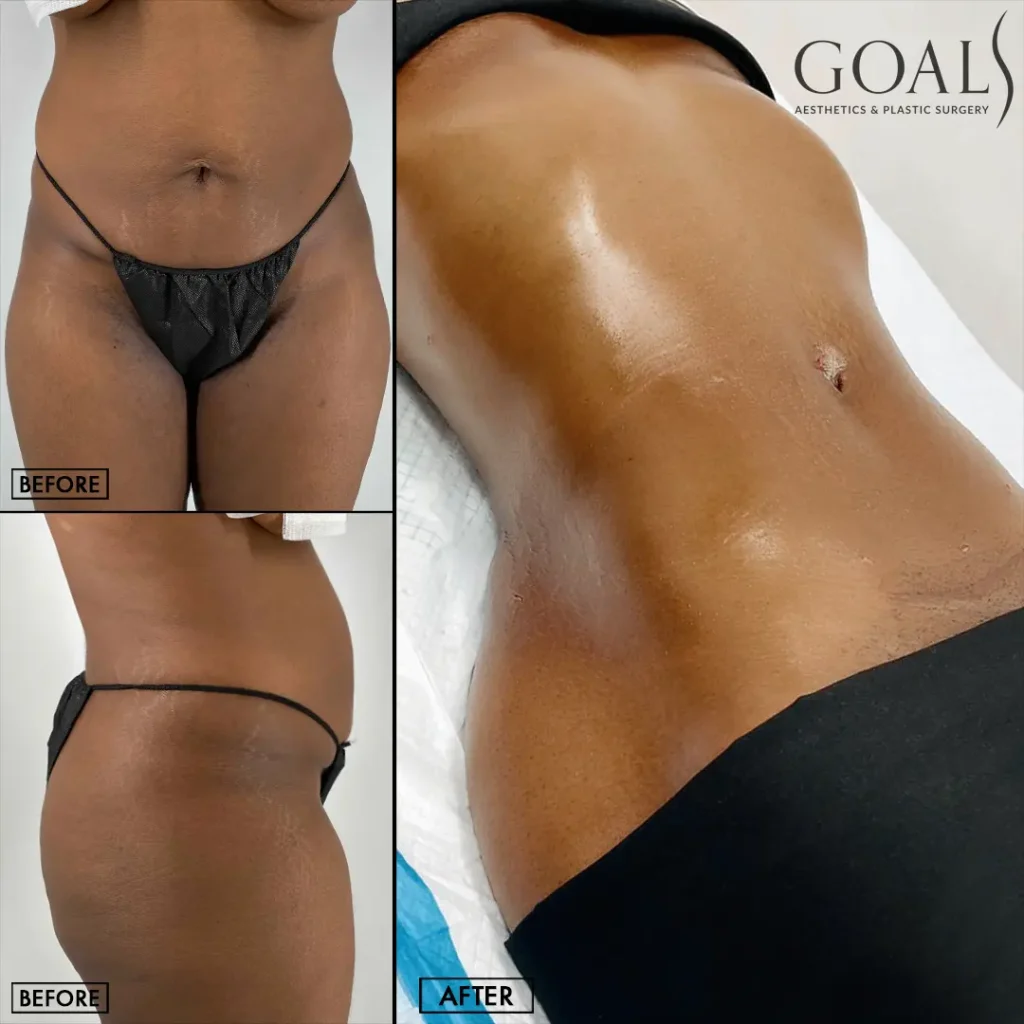 Before and after — Gaithersburg, patient 3