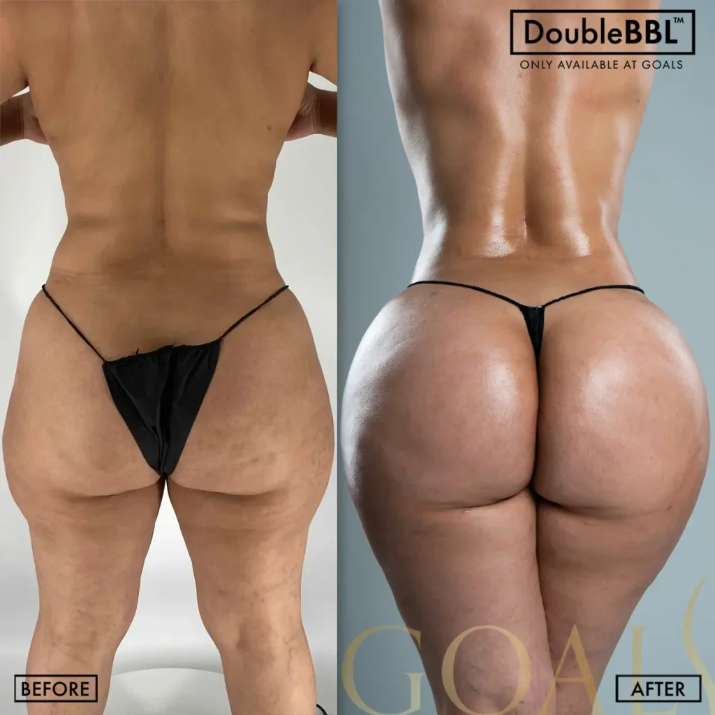 Before and after — Gaithersburg, patient 4