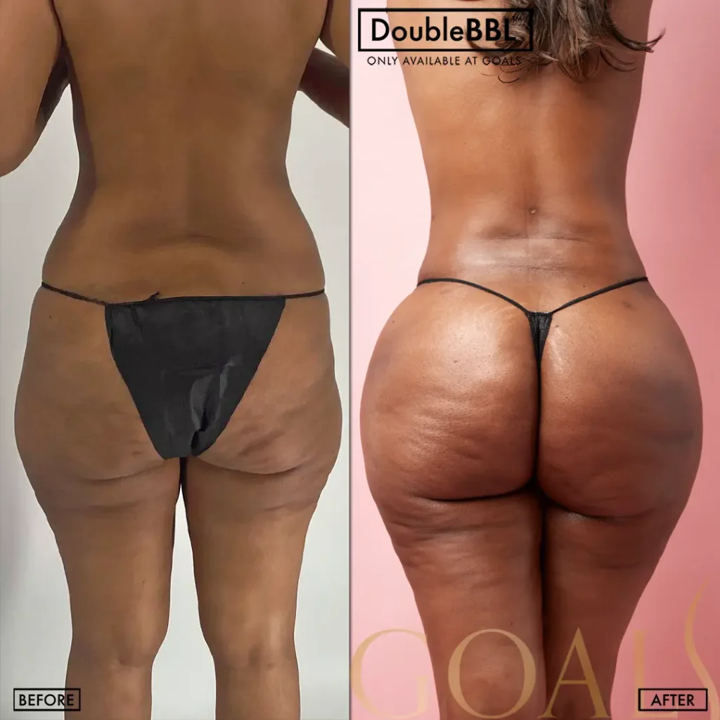 Before and after — Gaithersburg, patient 5