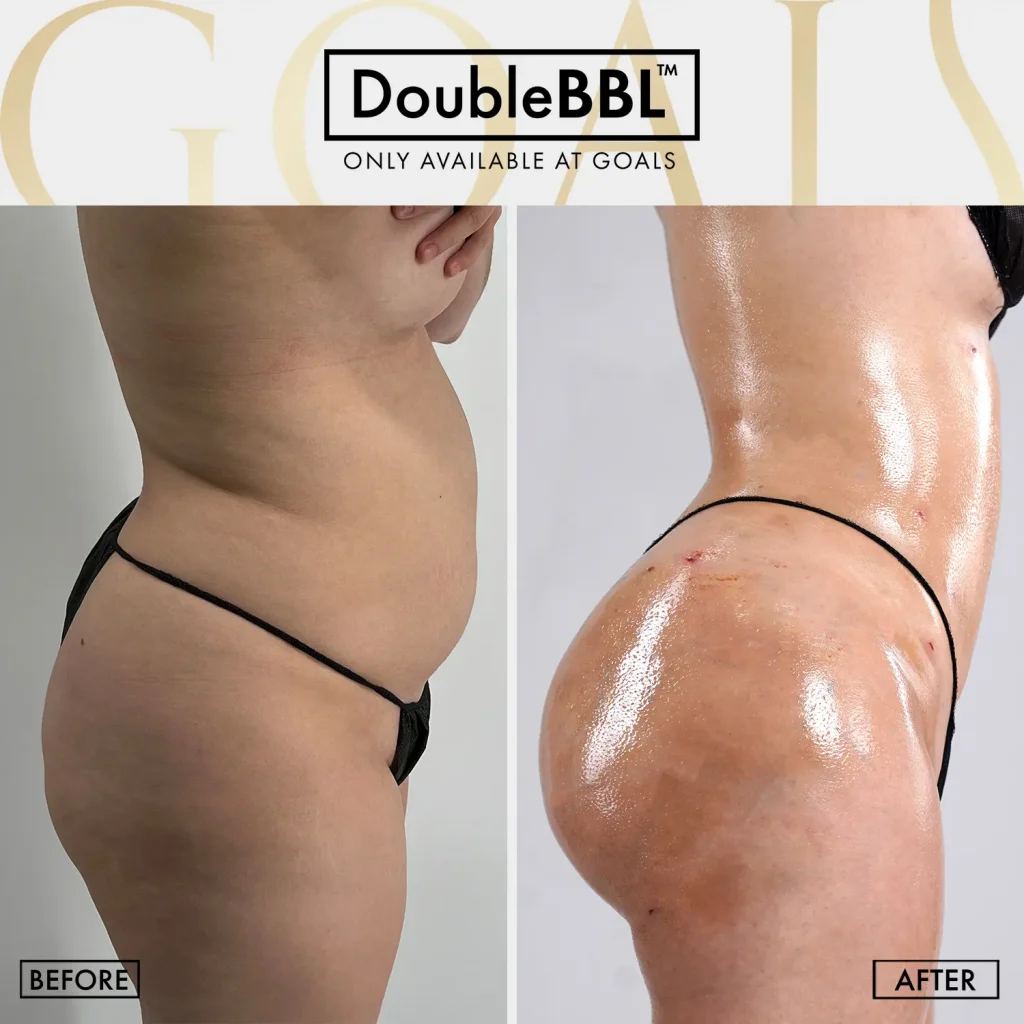 Before and after — Fair Lawn, patient 2