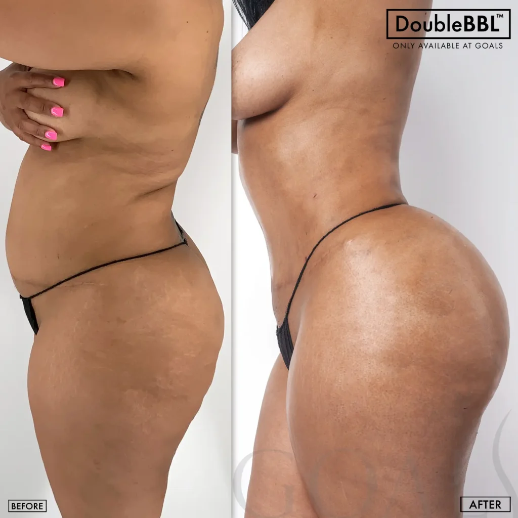 Before and after, patient 1