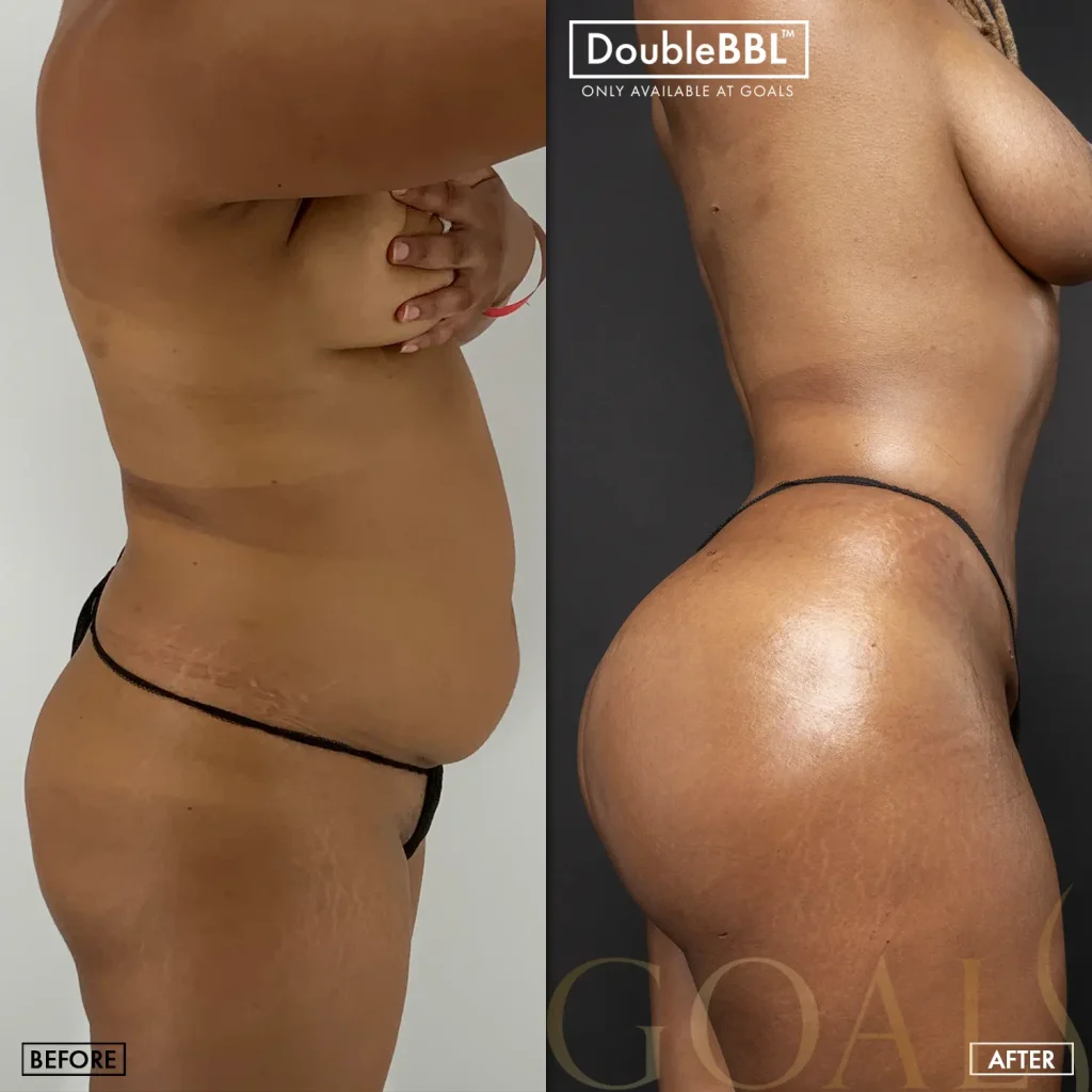 Before and after, patient 3