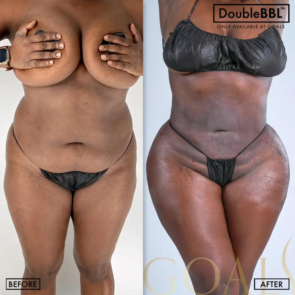 Before and after — Houston, patient 6