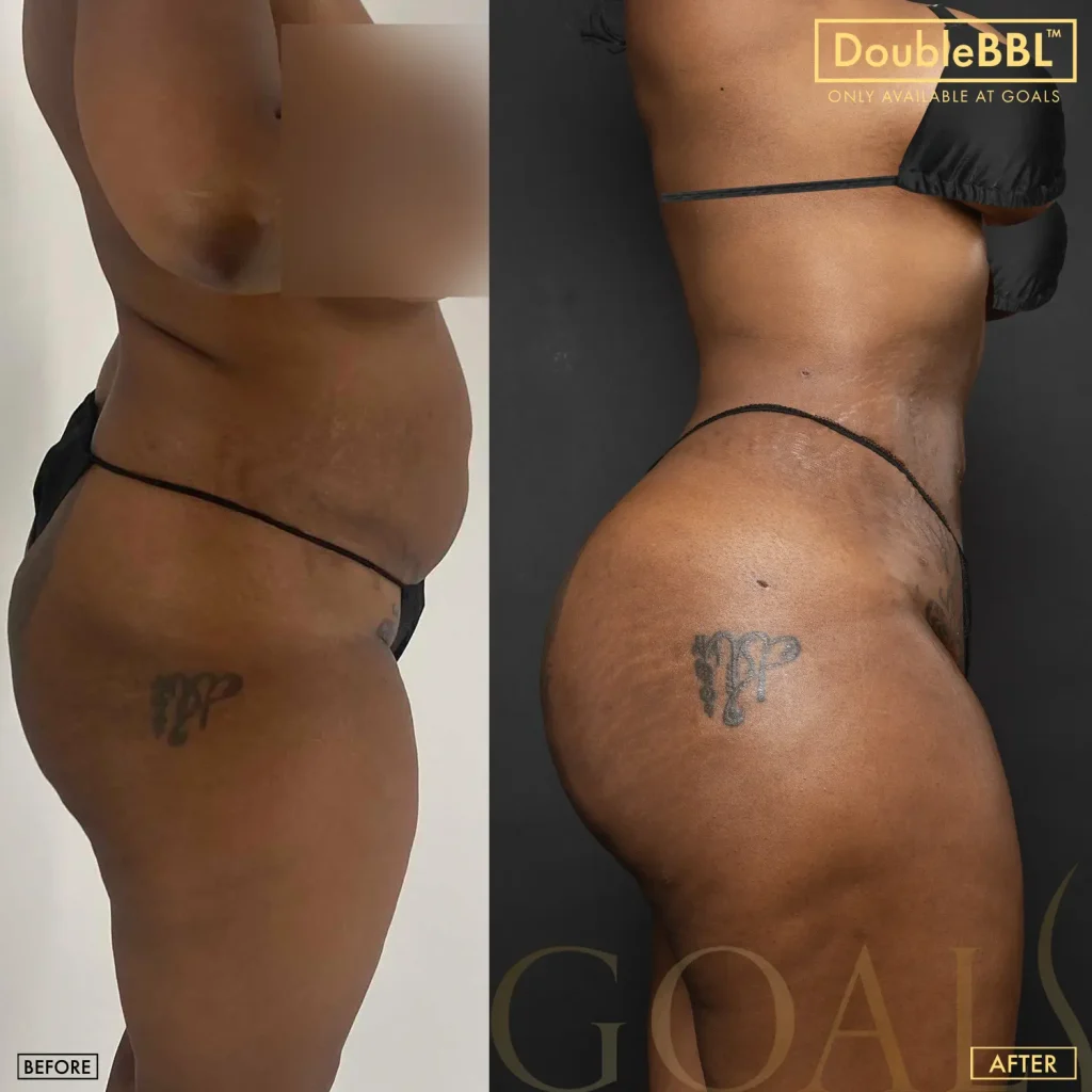 Before and after — Harlem, patient 6