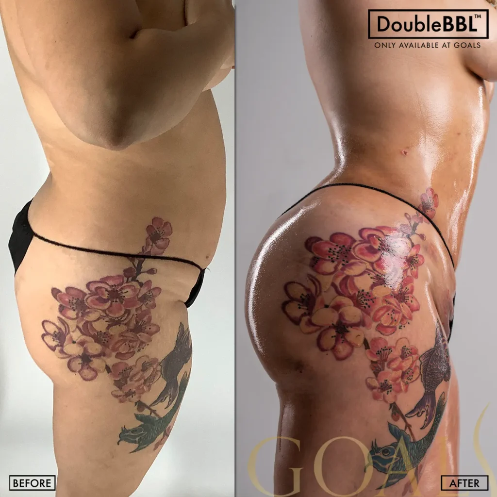 Before and after — Harlem, patient 3