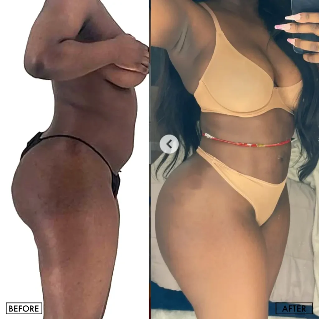 Before and after — Houston, patient 2