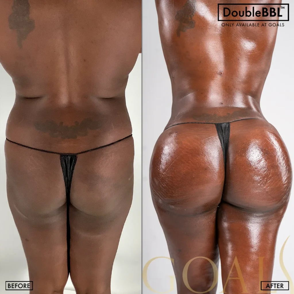 Before and after — Houston, patient 4
