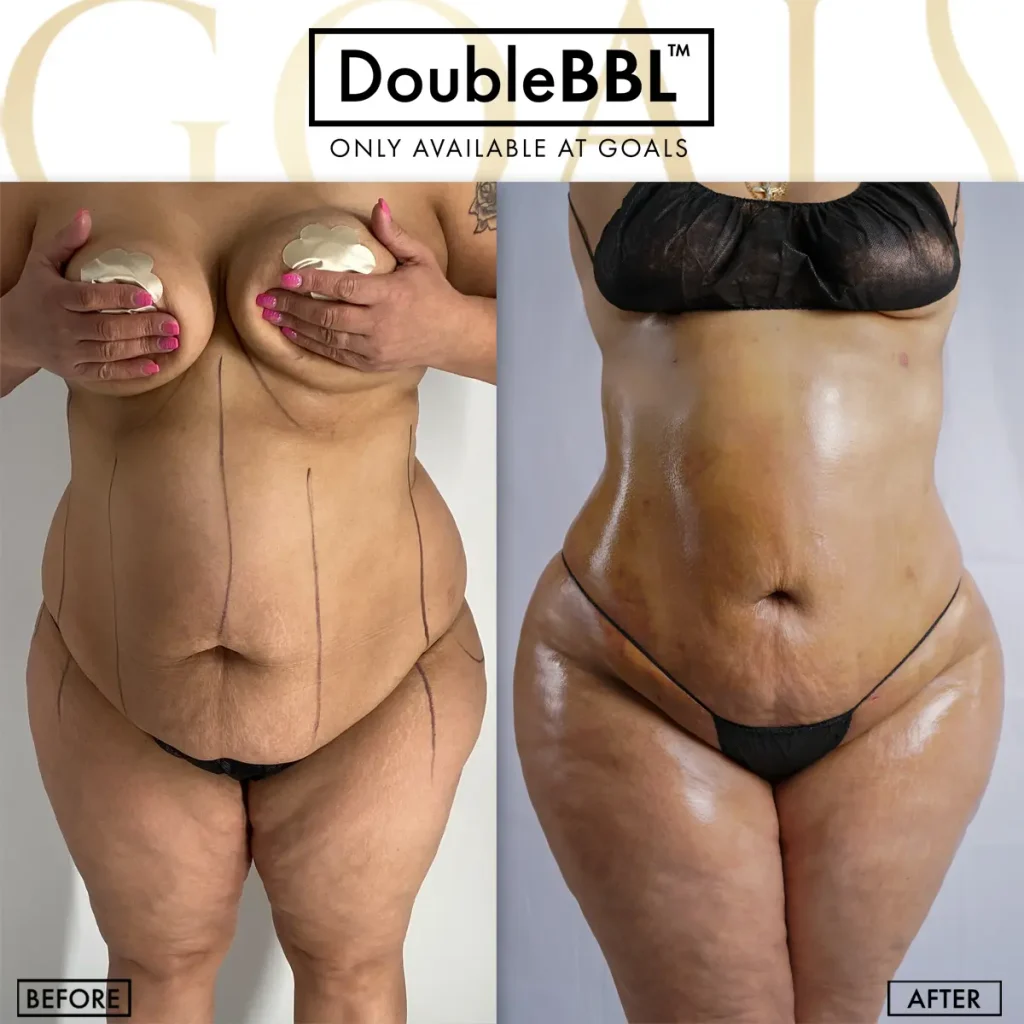 Before and after — Philadelphia, patient 4