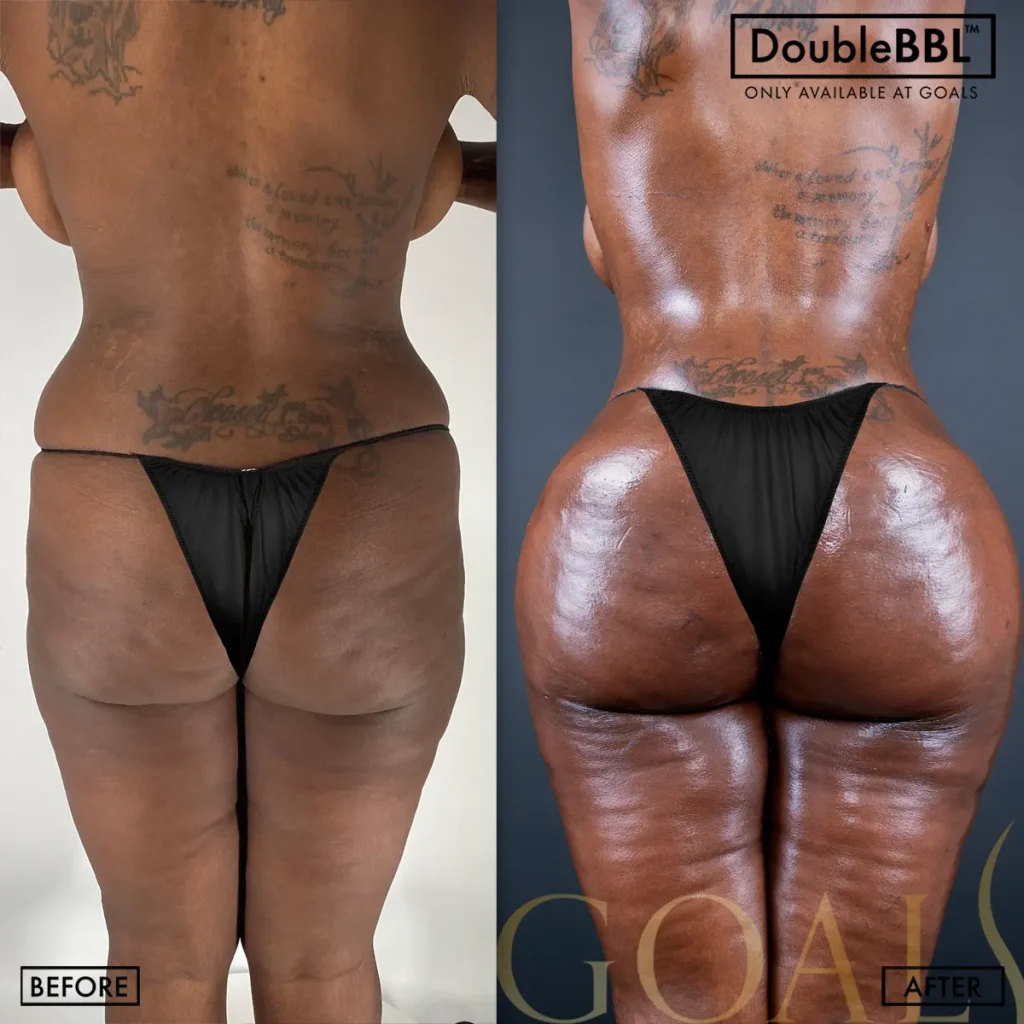 Before and after — Philadelphia, patient 5