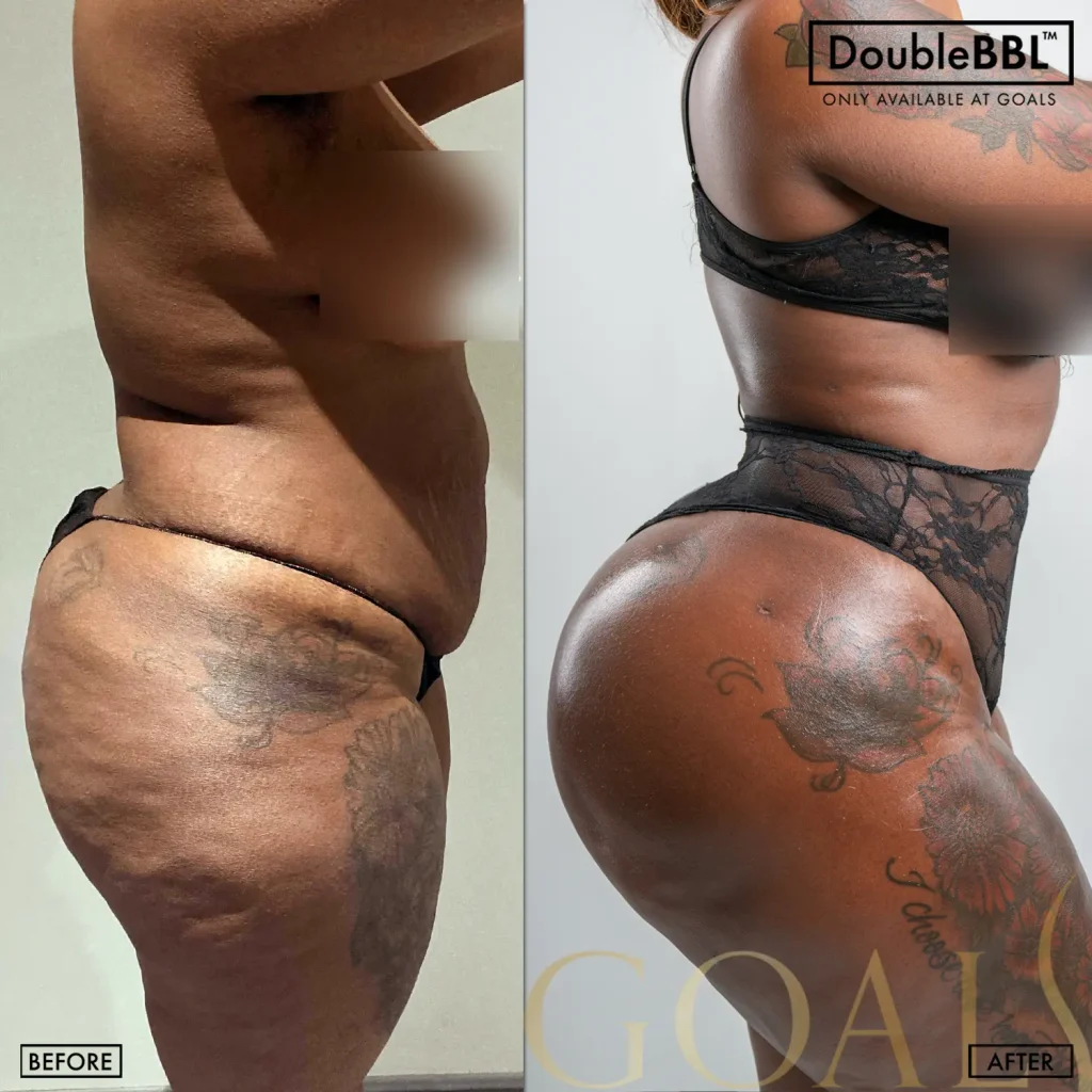 Before and after — Philadelphia, patient 6