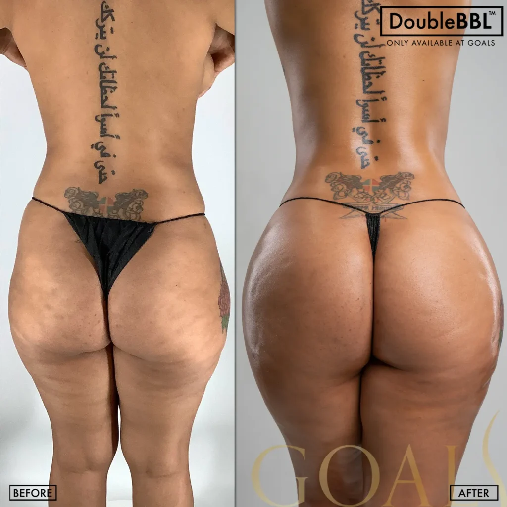 Before and after — Harlem, patient 3