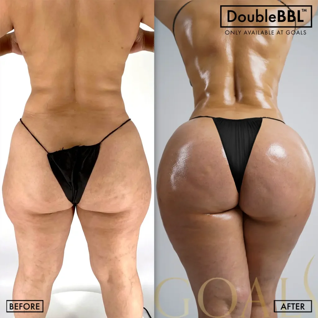 Before and after — Harlem, patient 6
