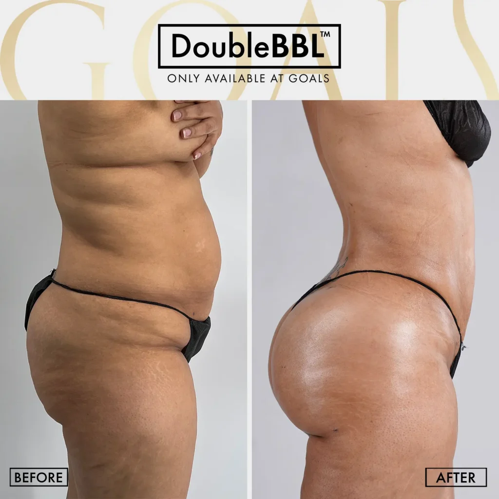Before and after — Fair Lawn, patient 5