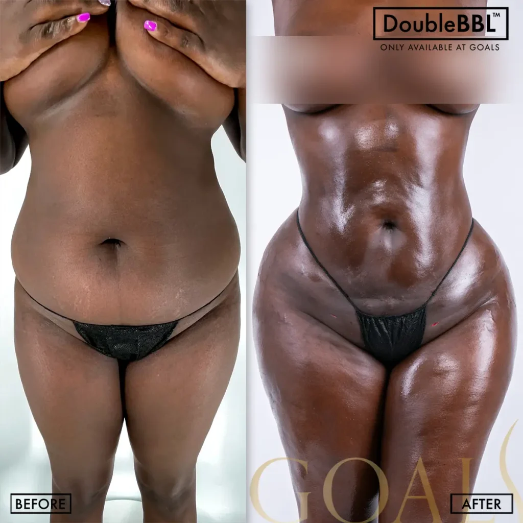 Before and after, patient 1