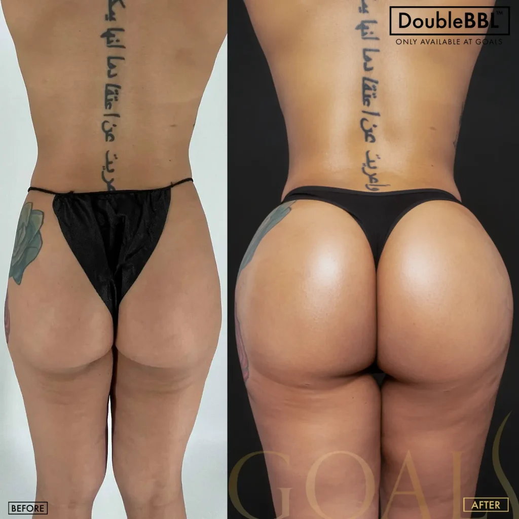 Before and after, patient 3
