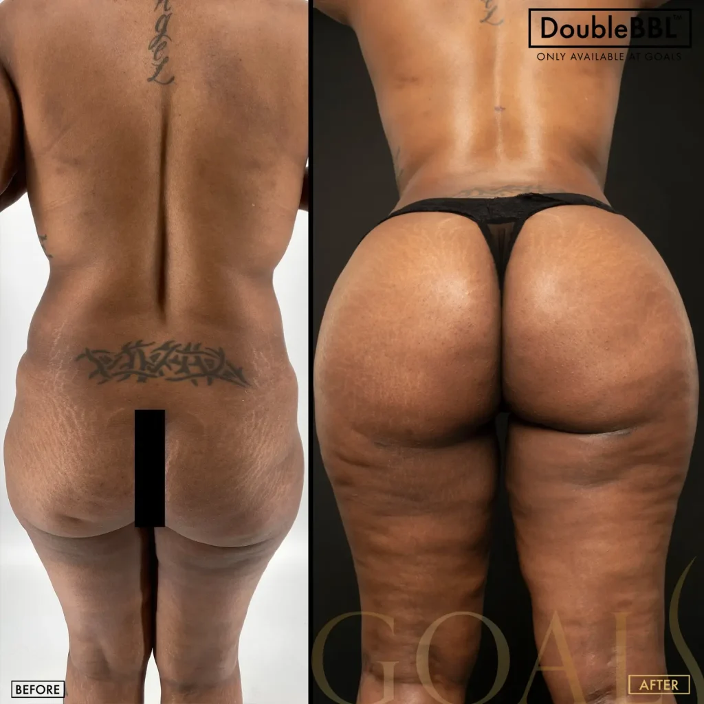 Before and after, patient 4