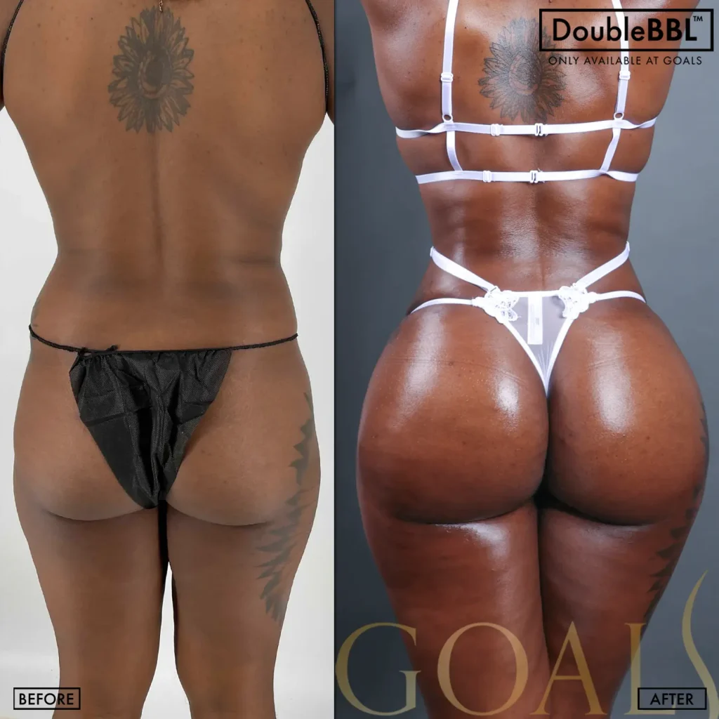 Before and after, patient 5