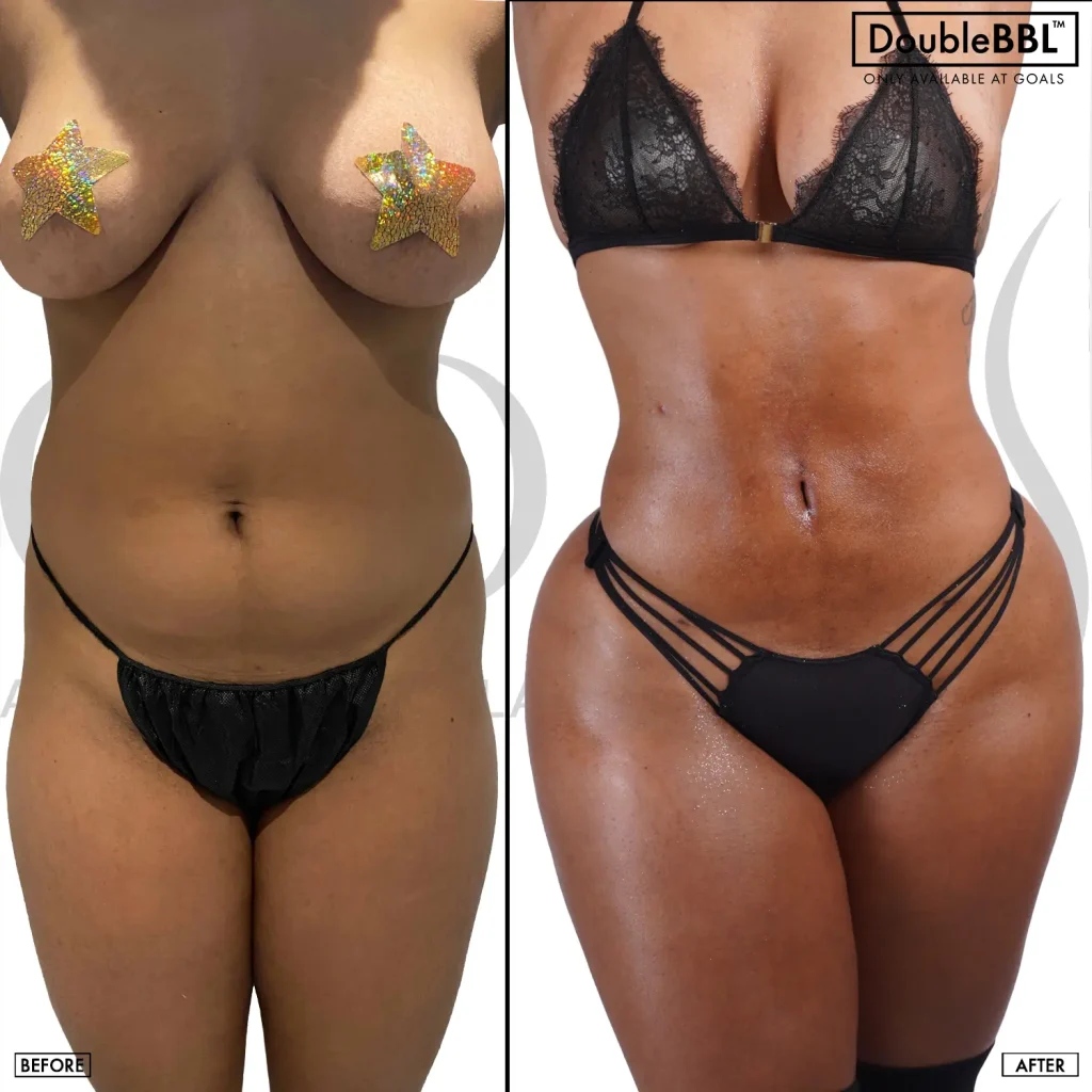 Before and after — Philadelphia, patient 4