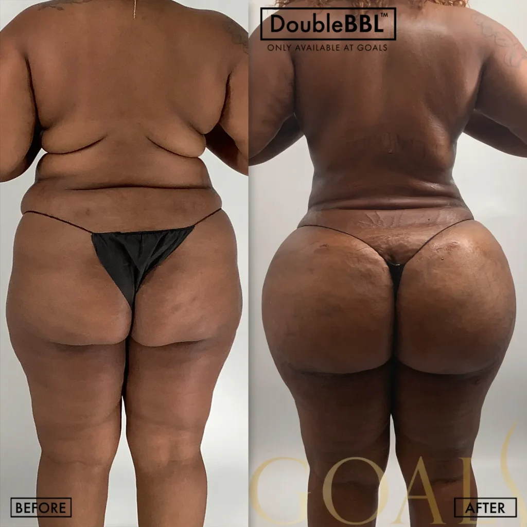 Before and after, patient 3