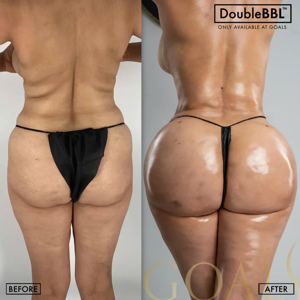 Before and after, patient 2