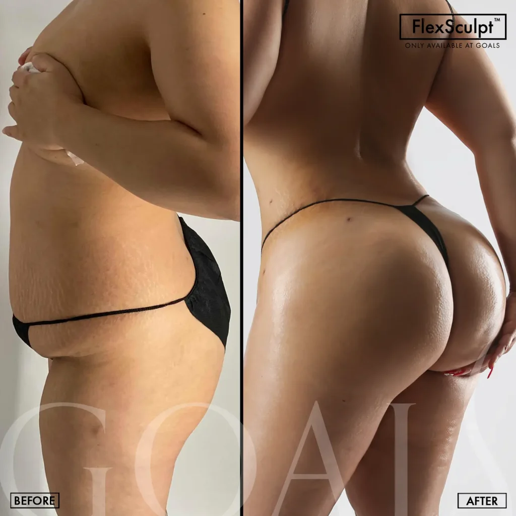 Before and after — Ridgefield, patient 5