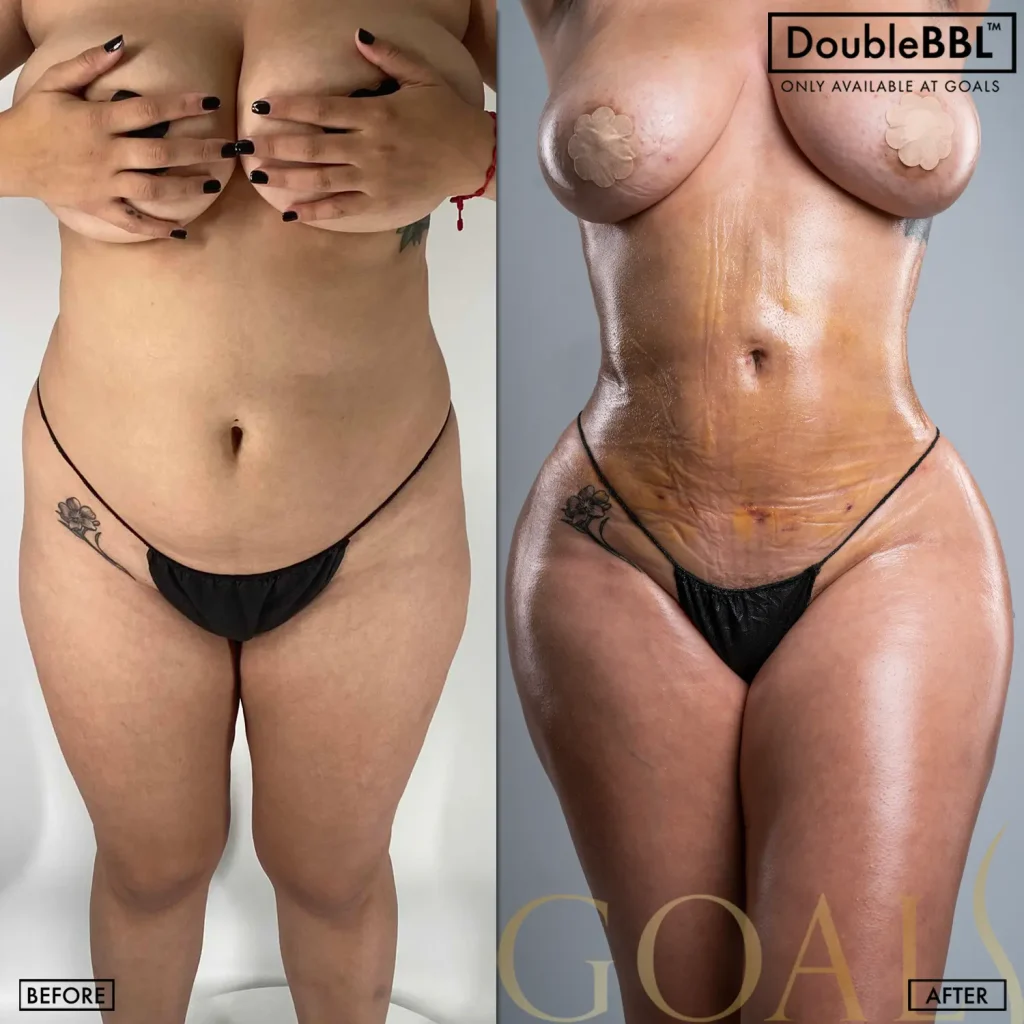 Before and after, patient 6