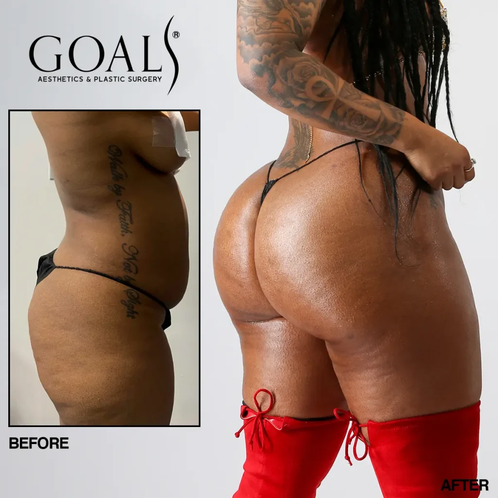 Before and after, patient 2