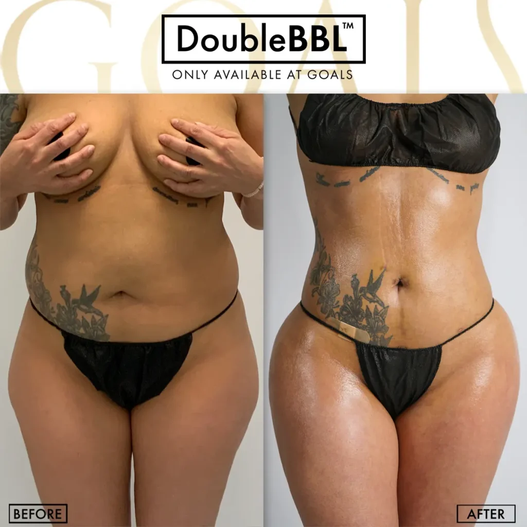 Before and after, patient 5