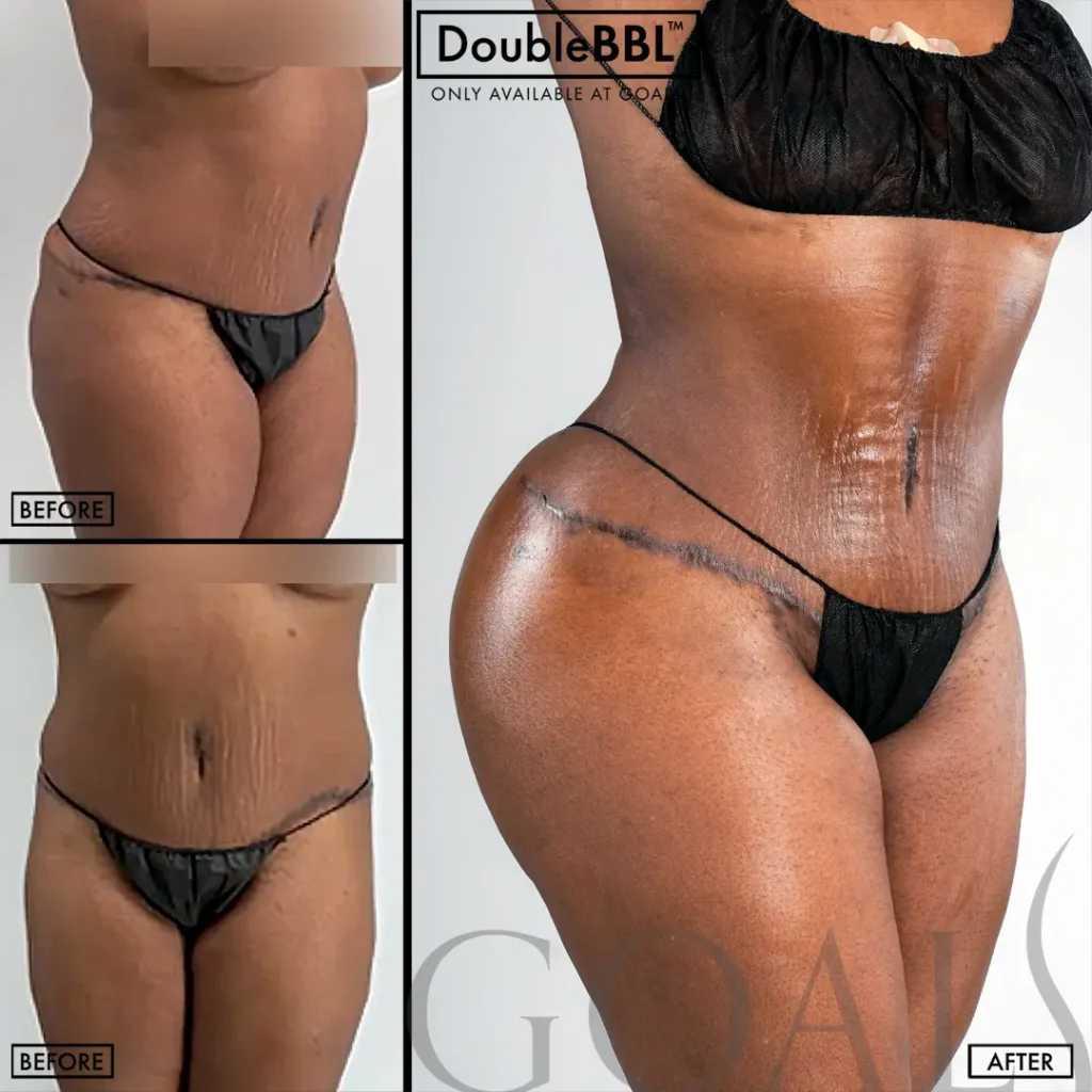 Before and after — Harlem, patient 2