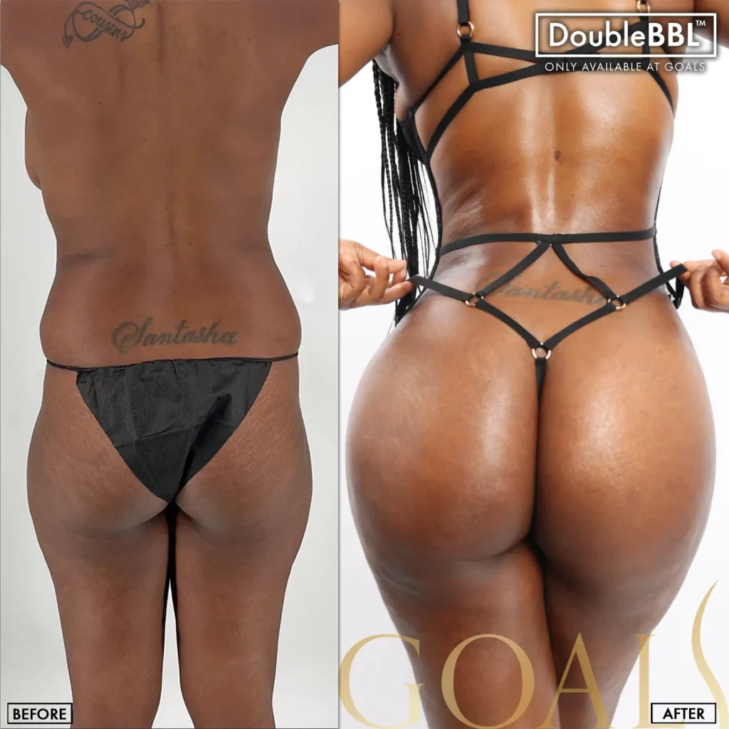 Before and after — Harlem, patient 3