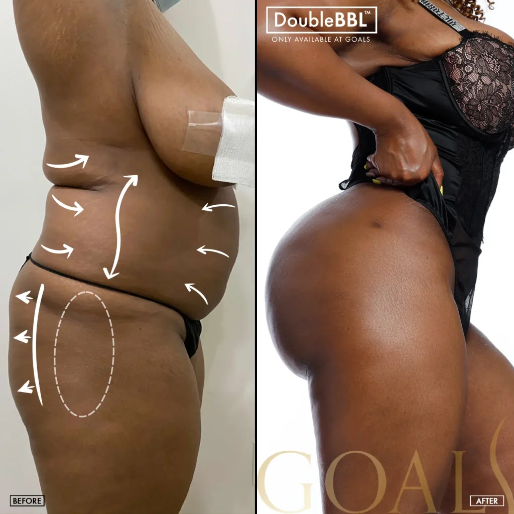 Before and after — Harlem, patient 6