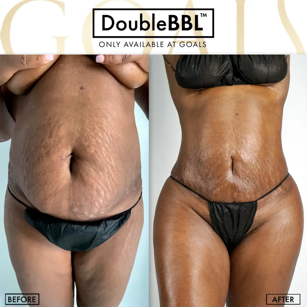 Before and after, patient 1