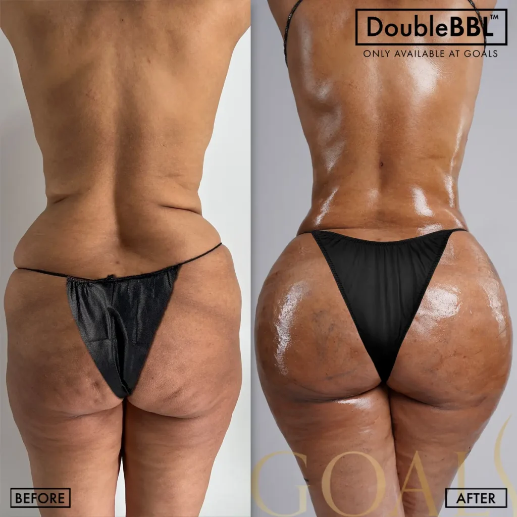 Before and after — Bronx, patient 5