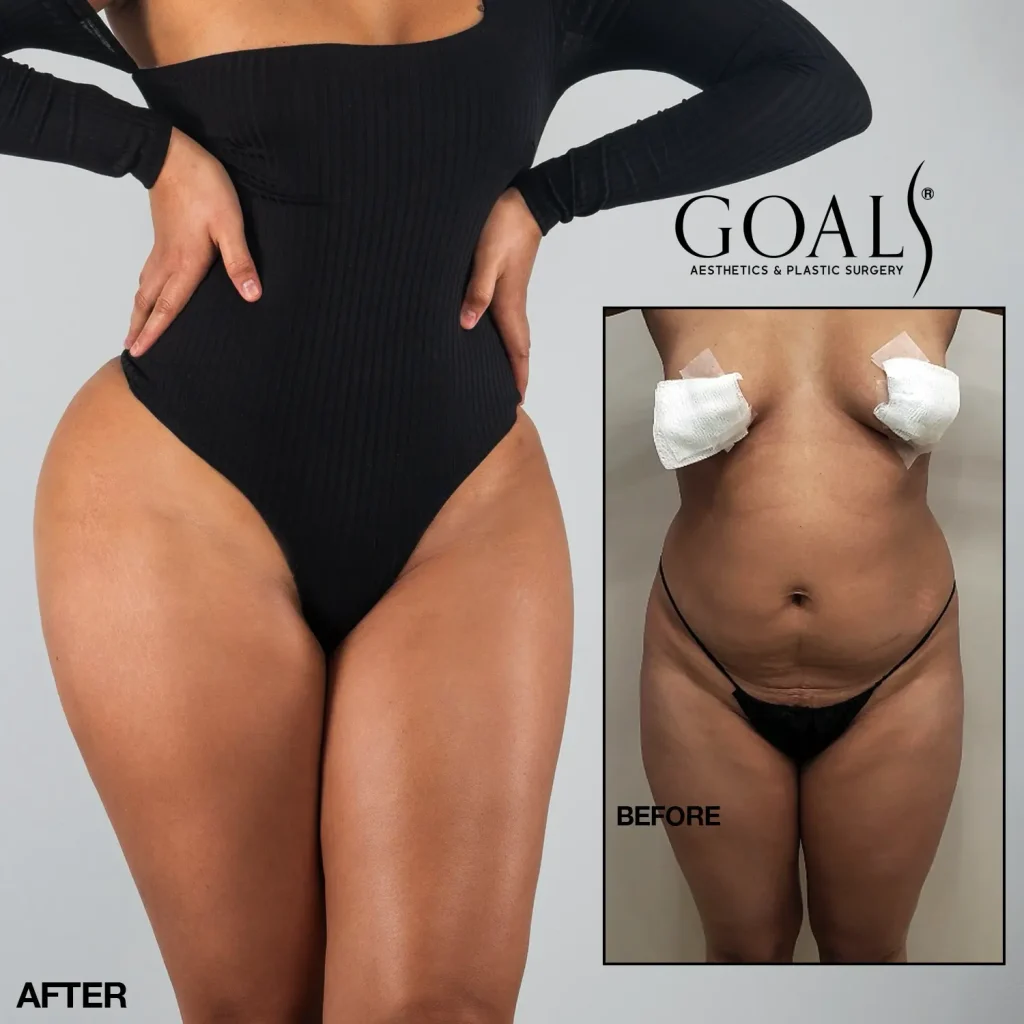Before and after, patient 4