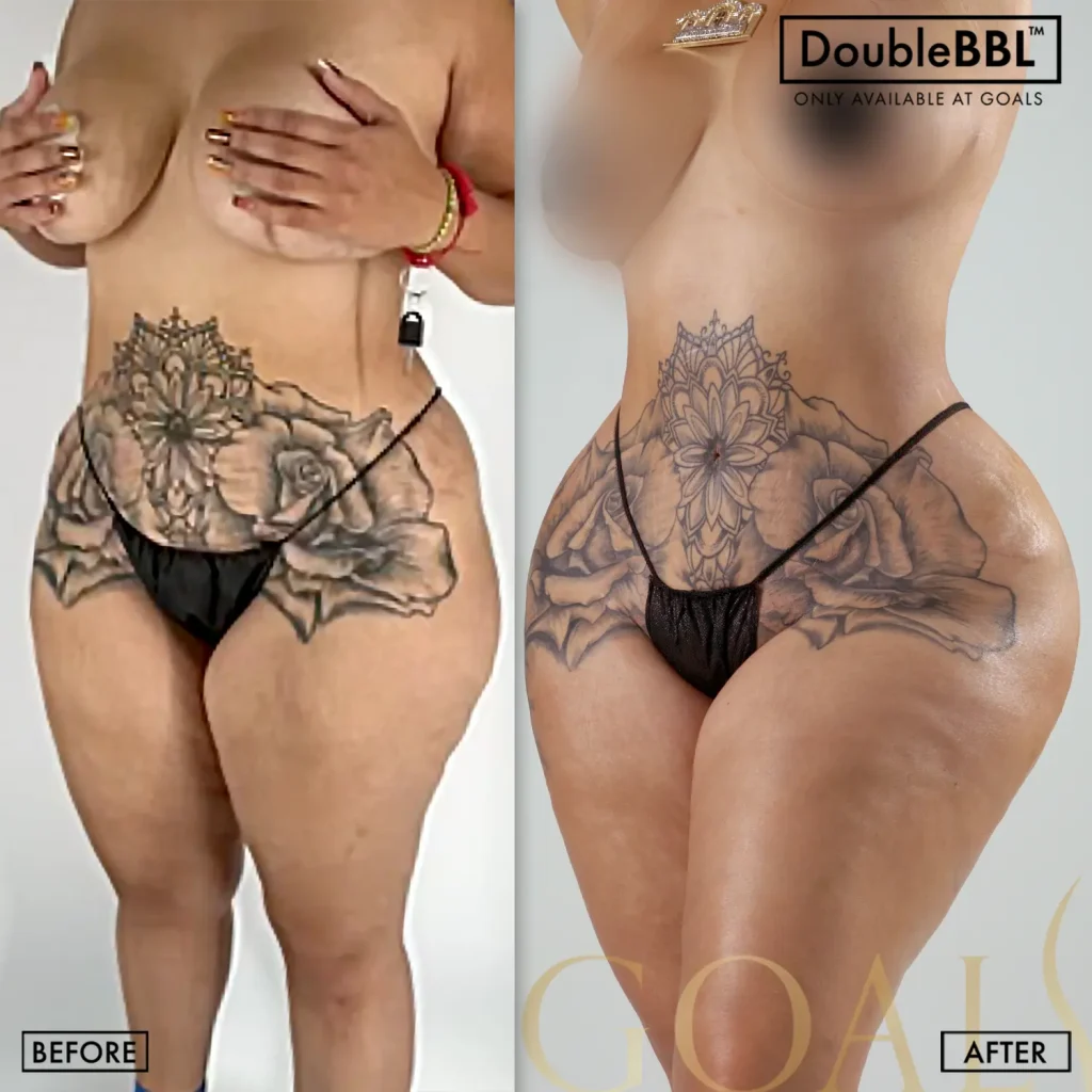 Before and after, patient 6