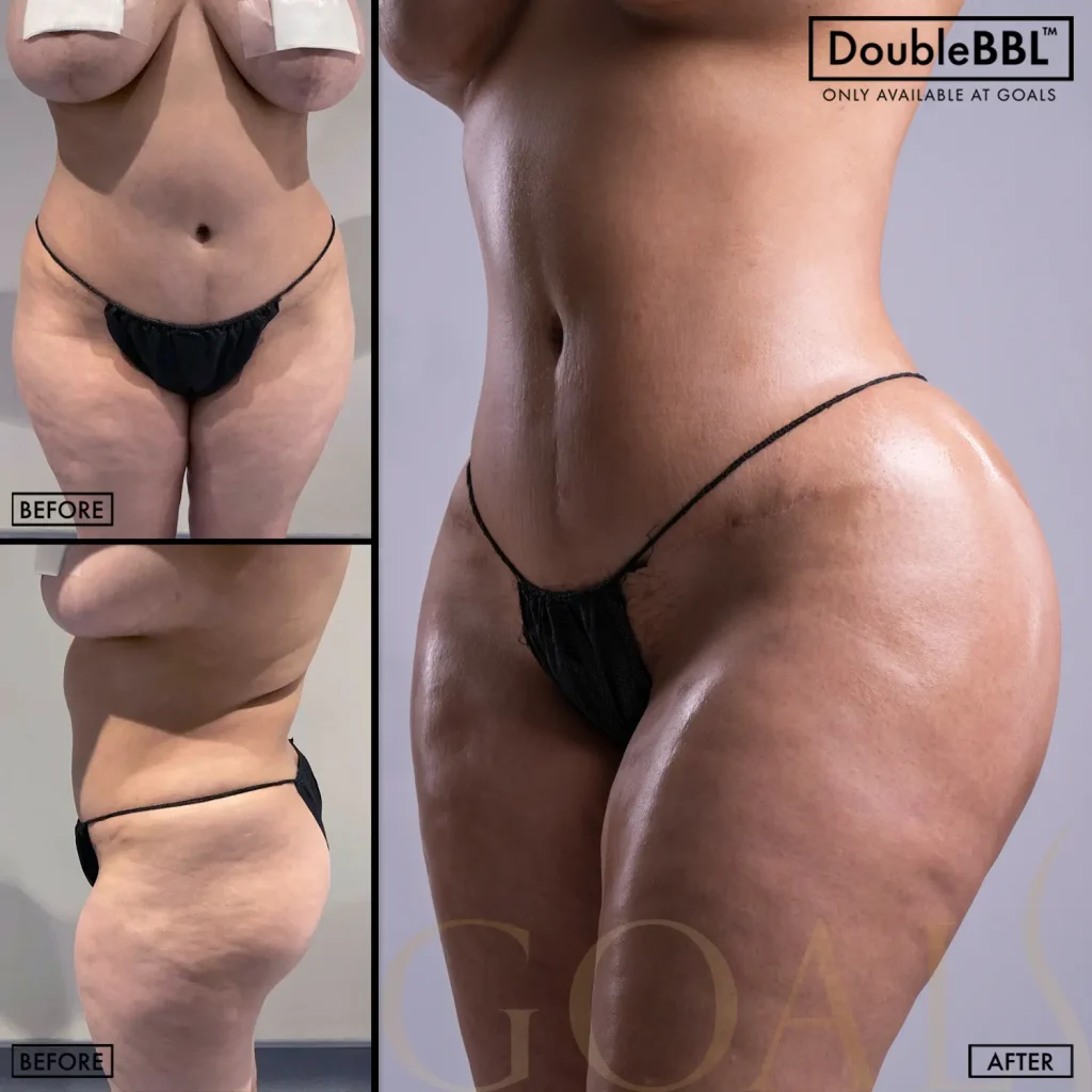 Before and after, patient 2