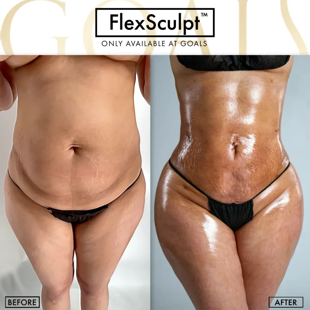 Before and after, patient 3