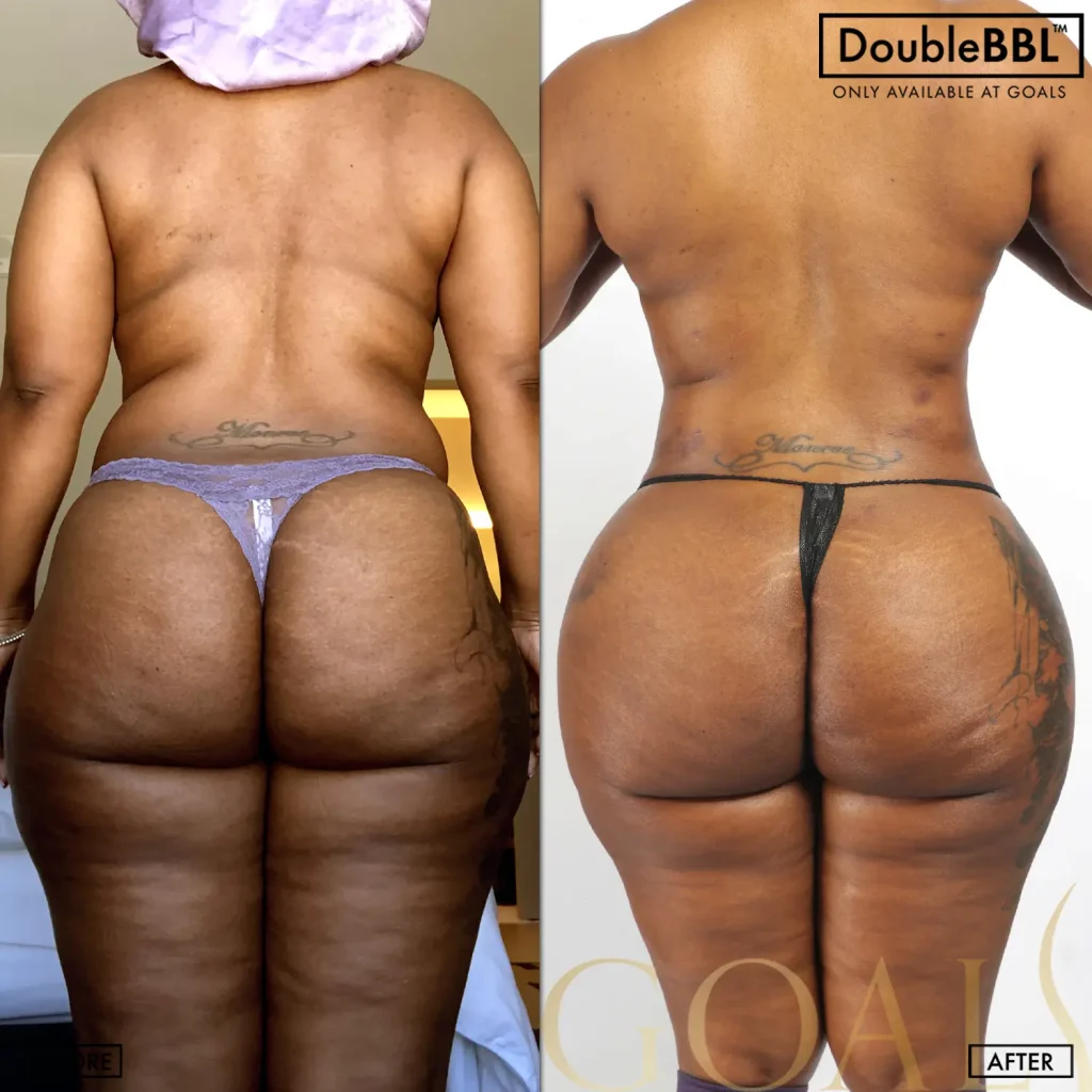 Before and after, patient 5