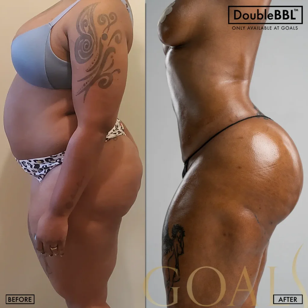 Before and after, patient 2