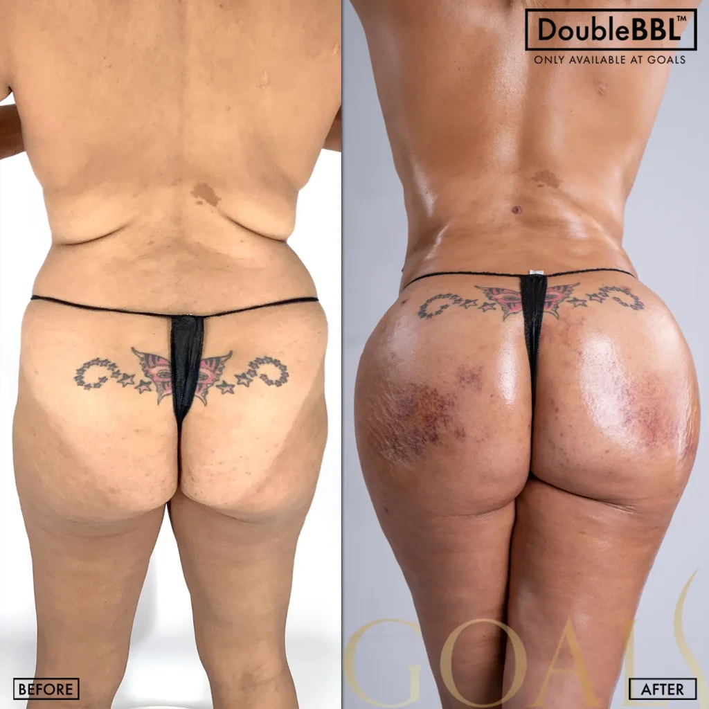 Before and after, patient 5