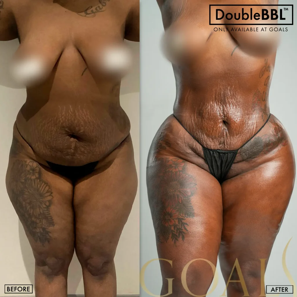 Before and after, patient 6