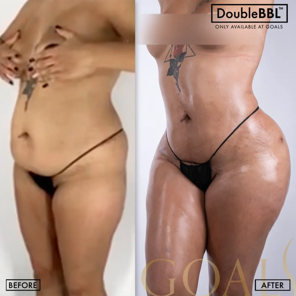 Before and after, patient 4