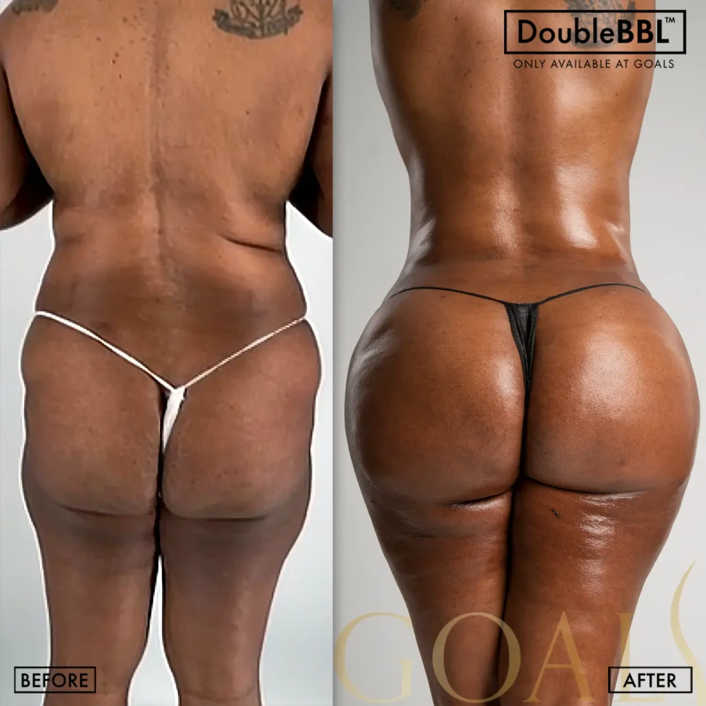 Before and after, patient 6