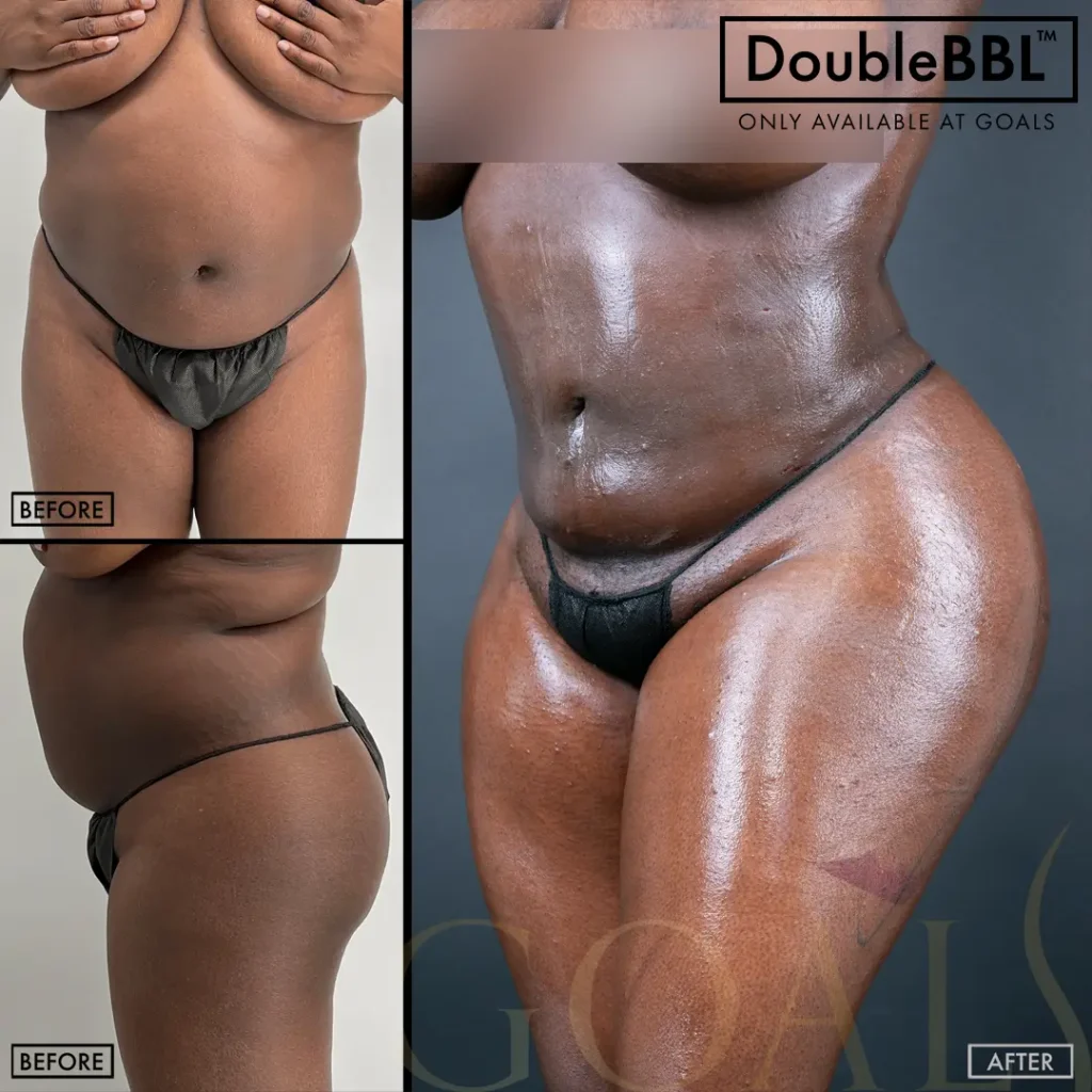 Before and after — Philadelphia, patient 5