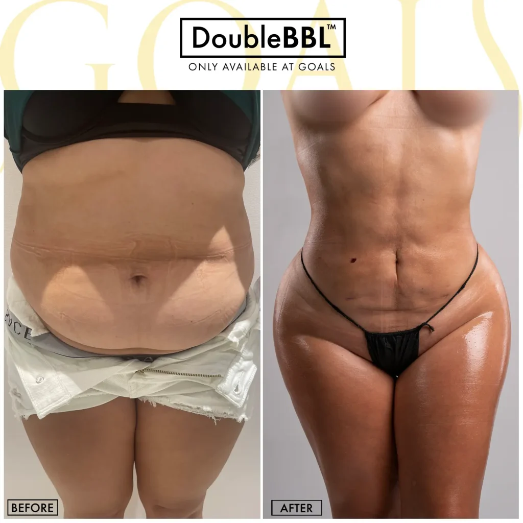 Before and after, patient 1