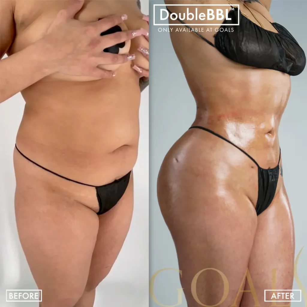 Before and after, patient 2