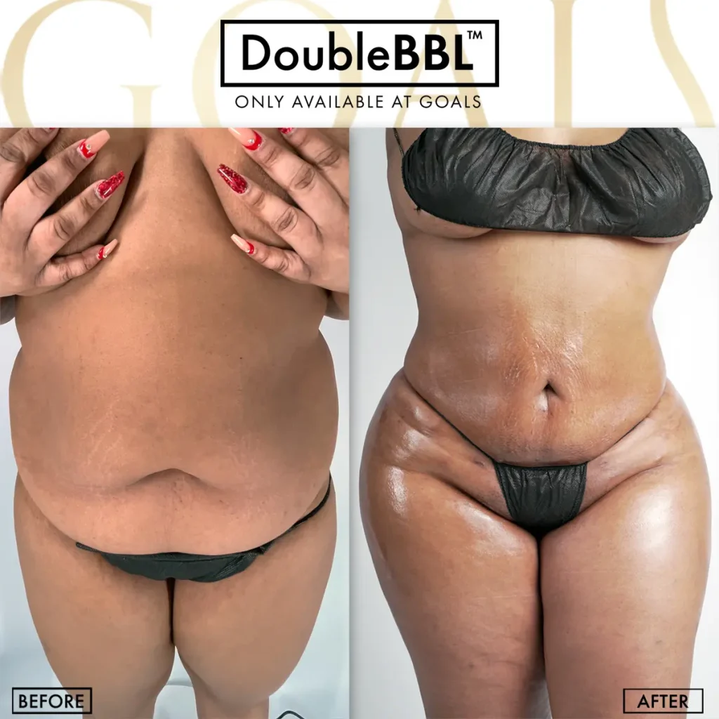 Before and after, patient 1