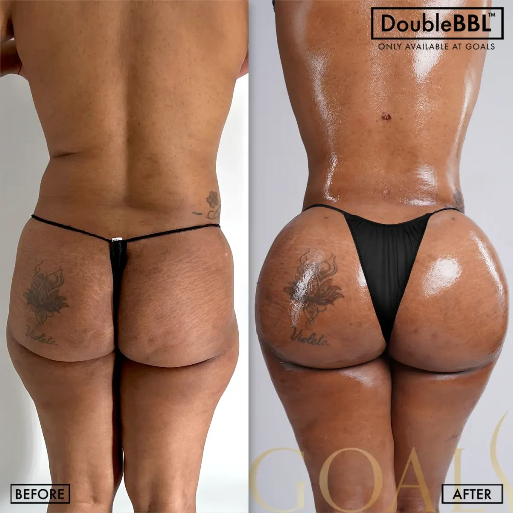 Before and after, patient 2